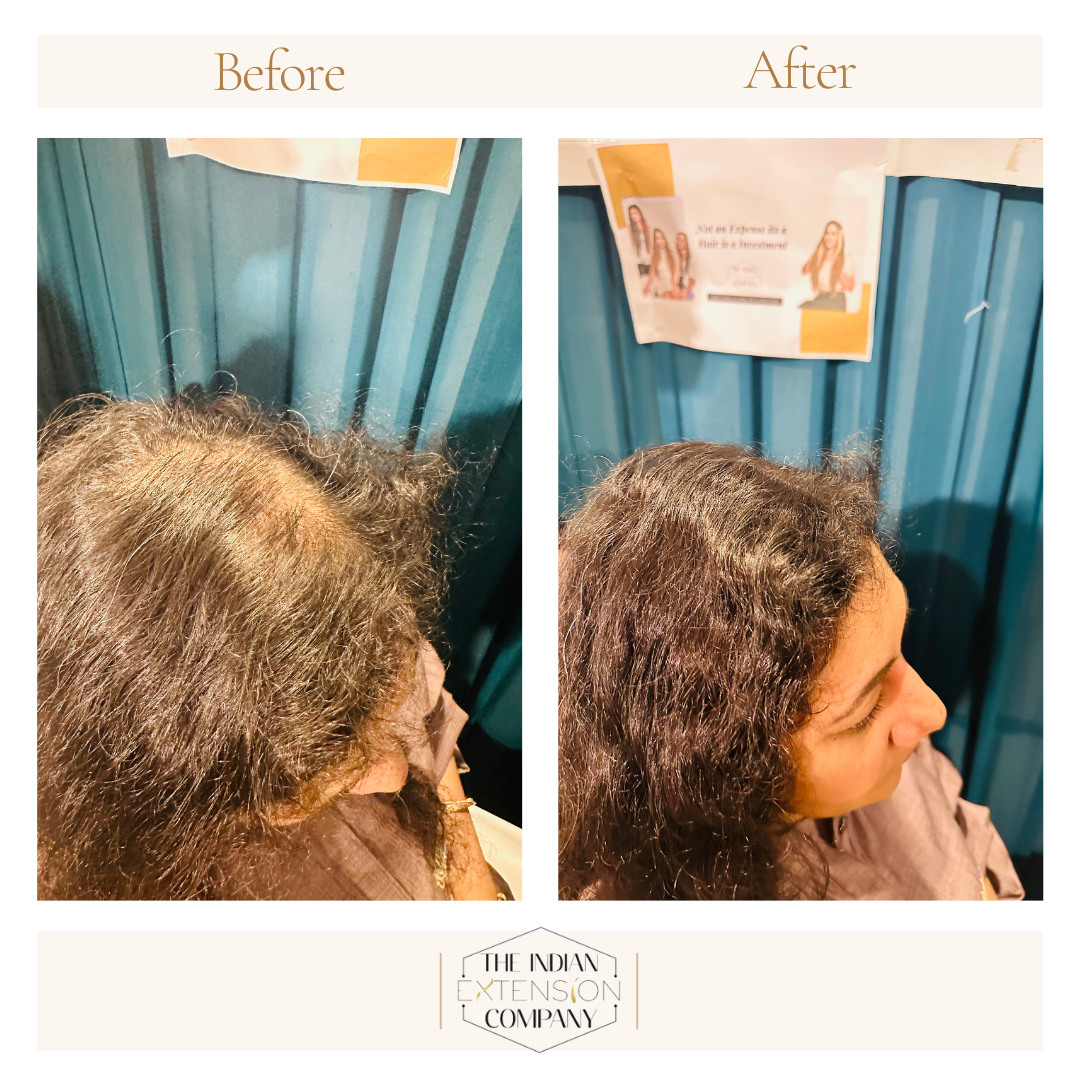 Curly Side Patches (Natural Black)